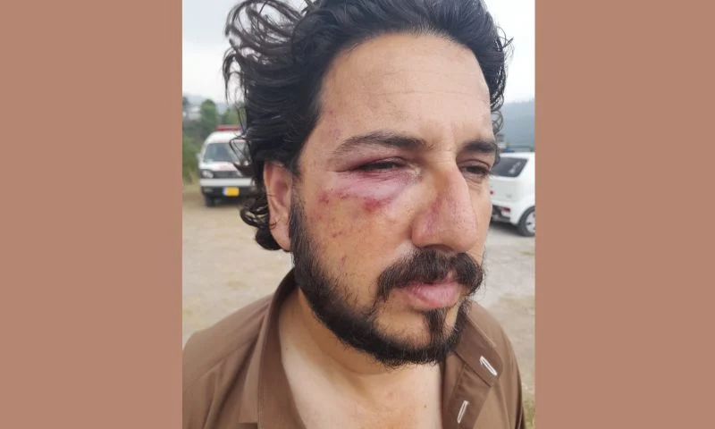 مدينة راولاكوت في كشمير الحرة واحتجاجات ضد لجنة العمل المشتركة - Rawalakot and protests against JAAC